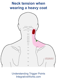 Pin On Temporary Neck Thing