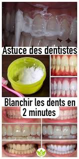 Genoux Et Coudes Fonces Les Recettes Maison Qui Marchent Gisella Pinshouse Blanchir Les Dents Dentifrice Naturel Blanchiment Dentaire Dentiste