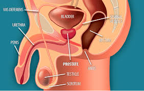 In practice, though, prostate cancer metastasis occurs most often in the lymph nodes and the bones. Treating Localized Prostate Cancer Effective Health Care Program