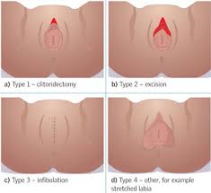 Bu sensor ile birlikte data logger gps kayıt edici yapabilecek bir arkadaş yada konu ile ilgili bilgisi olan var ise benimle iletişime geçer ise sevinirim. Female Genital Mutilation