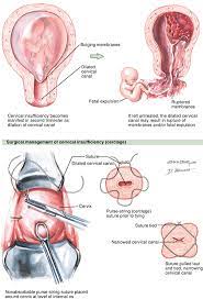 Obstetrical Etiologies Of Abdominal Pain Abdominal Key