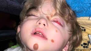 Fundraiser by Ryce Budnick : Alistair and his parents