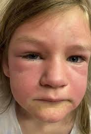 Interesting!  https://m.facebook.com/story.php?story_fbid=2882934988616738&id=100007007944327&sfnsn=mo 