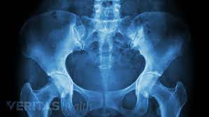 Radiographic Tests for SI Joint Dysfunction