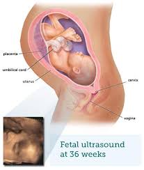 The baby accumulates more body fat. Fetal Ultrasound 8 Months Babycentre Uk