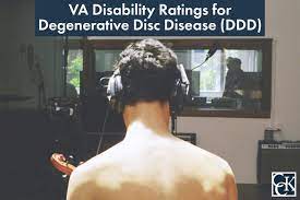 Va Disability Ratings For Degenerative Disc Disease Ddd Cck Law