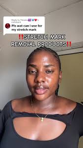 Does Handy Andy Remove Stretch Marks