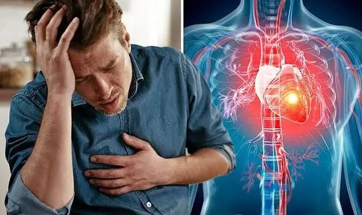 Gia tăng nguy cơ tai biến tim mạch ở người trẻ