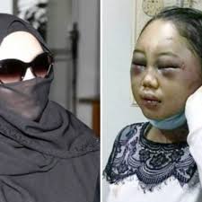 Rozita didakwa dengan sengaja menyebabkan kecederaan parah terhadap suyanti sutrinso dengan menggunakan sebilah pisau berhulu biru, sebatang pengelap lantai, sekaki payung, sebatang rod besi berwarna biru, sebatang alat mainan kucing dan penyangkut baju berwarna putih yang digunakan. Suri Rumah Yang Digembar Gemburkan Sebagai Datin Akhirnya Di Penjara Lapan Tahun