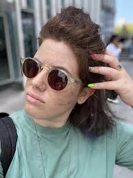 העור יודע לפנינו. לפני חצי שנה ויותר נמצאתי במקום מאוד שחור בחיים והעור שלי  התחיל לדבר אבל לא הקשבתי לו. גירודים, פריחות, התקלפויות. לא בדקתי אותו כמו  שסירבתי לבדוק את הנפש שלי