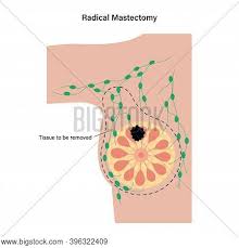 We did not find results for: Female Radical Vector Photo Free Trial Bigstock