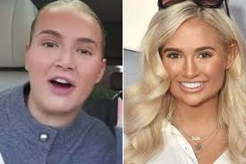 Molly-Mae furiously hits back claims she's had a nose job & insists she'll  take LIE DETECTOR test to prove the truth