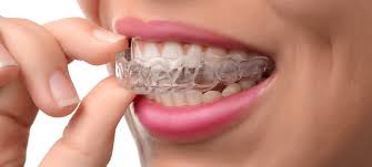Search for free consultation dubai with addresses, phone numbers, reviews, ratings and photos on uae business directory. 10 Best Invisalign Orthodontists In Dubai That Offers Free Consultation