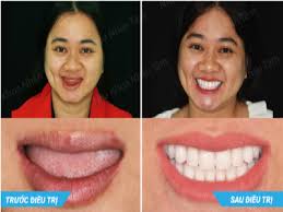 Ts.Bs Võ Văn Nhân