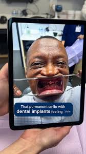 That permanent smile feeling 😁. Love how you live, smile with confidence  and eat the food you love. , #AspenDental #implantdenture #dreamcometrue  #beforeandafter #smile #smiletransformation ...