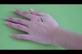 Also die aktion mit den filzstiften hab ich nicht mehr wiederholt. Video Edding Auf Der Haut Entfernen So Geht S