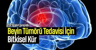 Beyin Tumoru Bitkisel Tedavisi Ibrahim Saracoglu Dogal Beyin Tumoru Saglik Beyin
