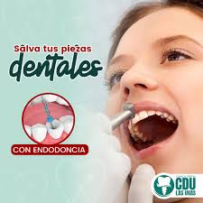 👉La #Endodoncia ayuda a salvar tus dientes en #ClínicaDentalLasUvas😎 te  podemos ayudar. Puedes llamar o escribir al 👉 3179-2404 o abriendo este  enlace: https://wa.link/thoilz #Dentista #SaludBucal #Dientes #Odontología  #Tegucigalpa