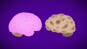 We do not fully understand how genetics and lifestyle risk interact with . A Healthy Lifestyle May Offset Genetic Risk For Alzheimer S 5newsonline Com