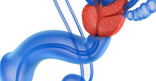 Welcome to this prostate massage video series done by jonas sterling that explains everything you need to know to learn how to massage,milk and stimulate the prostate. Prostate Massage Therapy Definition Types And Risks