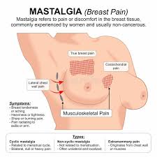 Image result for Mastalgia