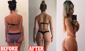 Perth woman reveals the secrets to a 'perfect' bubble butt | Daily Mail  Online
