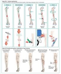 Twitter Radiologicworld Foamrad Foamed Radiology Imaging Radiologist Radiographer Radtech Xraytech Nurse Emergen In 2020 Xray Tech Radiologist Radiographer