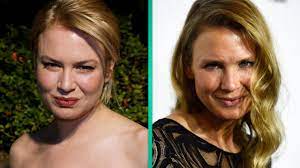 Renee zellweger pens response to plastic surgery rumors: What Did Renee Zellweger Do To Her Face Plastic Surgeon Weighs In Entertainment Tonight