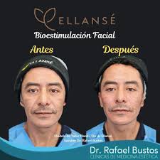 Dr. Rafael Bustos