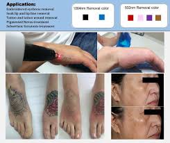 Also, if the tattooist injects the pigments too deeply into the. Permanent Makeup Digital Tattoo Laser Remover Machine China Tattoo Removal Tattoo Machine Made In China Com
