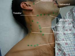 Neck lumps often relate to underlying enlarged lymph node(s) (known as lymphadenopathy). Uc San Diego S Practical Guide To Clinical Medicine