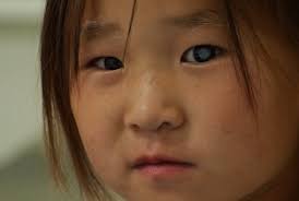 Sight charity Orbis in DRTV debut