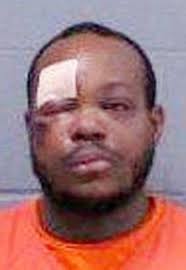 Assault suspect also took a beating