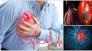 Nyeri dada atau ketidaknyamanan pada dada, nyeri ini bisa menjalar ke leher. 10 Cara Mengobati Penyakit Jantung Sesuai Jenis Gangguan Jantungnya Bangka Pos
