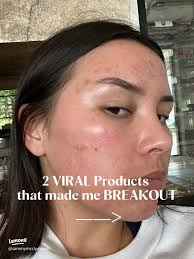 2 VIRAL Products that made me BREAKOUT
