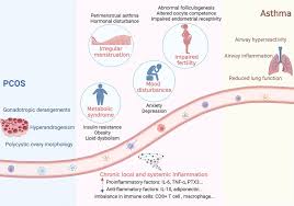 Frontiers | Associations Between Asthma and Polycystic Ovary Syndrome:  Current Perspectives