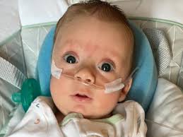 Fundraiser for Ashley Gregory by Katie Lewis : Cameron's battle with a rare  brain defect