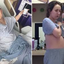 Malignant lesions of the ovaries include primary lesions arising from normal structures within the ovary and secondary lesions from cancers arising elsewhere in the body. Woman Reveals Her Bloated Stomach Was Ovarian Cancer Rsvp Live