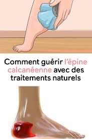 Les crevasses des talons apparaissent lorsque la peau de cette zone est trop sèche et affaiblie, donc une étape fondamentale pour éviter les talons la mauvaise utilisation de la chaussure est aussi un facteur qui renforce l'apparition de crevasses sur les talons. Comment Soigner L 39 Eperon Du Talon Avec Des Traitements Naturels Avec Comment Des L39eperon Feet Care Health Medical