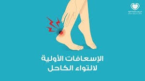 تعرف على علاج التواء الكاحل بأسهل الطرق Youtube