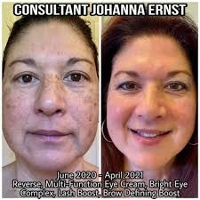 You absolutely deserve to achieve your skin goals! ✨ Treat yourself to the  #PutingDeserveMoWithRegularUse Routine Starter Kit. With a little  consistency, you'll see that skin you've been dreaming of. Go ahead, you