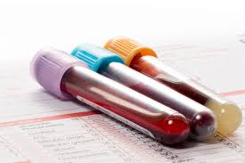 Proteine c reflex elevee et penoso au ventre. Proteine C Reactive Elevee Et Mal Au Ventre Comparte Este Discernible