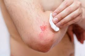 Maybe you would like to learn more about one of these? How To Help Heal Wounds Faster San Antonio Tx Er