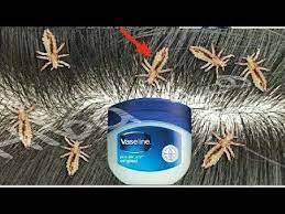 هل تعلم ما هي أسباب ظهور القمل في شعر الرأس عند الأطفال التخلص من القمل والصيبان للأبد youtube vaseline original vaseline vaseline bottle