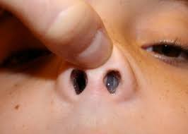 Post Nasal Drip Bad Breath Useful Information For You Home Remedies For Allergies Post Nasal Drip Remedy Home Health Remedies