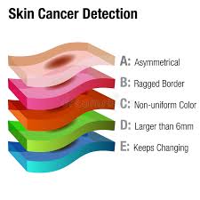 Signs And Symptoms Of Skin Cancer Stock Vector