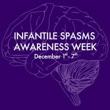Image result for Infantile Spasms