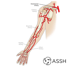 It is a central communication that unites the internal carotid and vertebrobasilar systems. Body Anatomy Upper Extremity Vessels The Hand Society