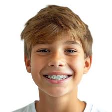 Orthodontists Chandler