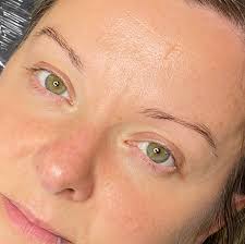 Amy Mc Alorum Beauty & Cosmetic tattooing